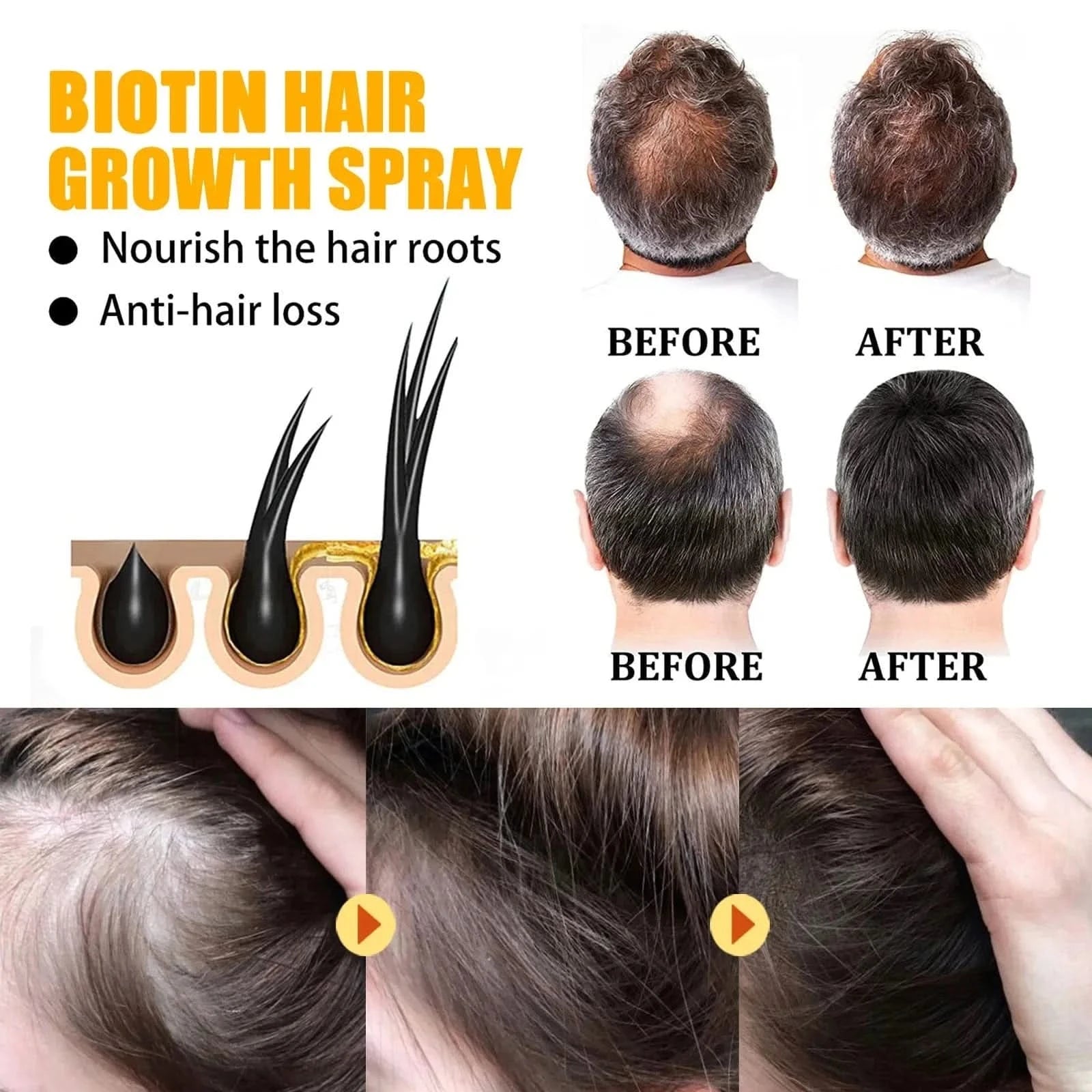 EELHOE Biotin Hair Growth & Repair Spray