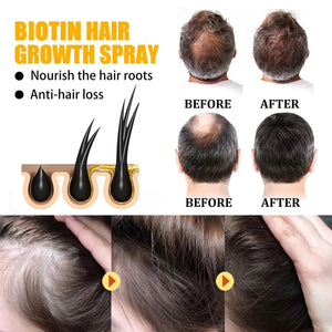 EELHOE Biotin Hair Growth & Repair Spray