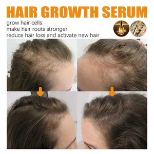 EELHOE Biotin Hair Growth & Repair Spray